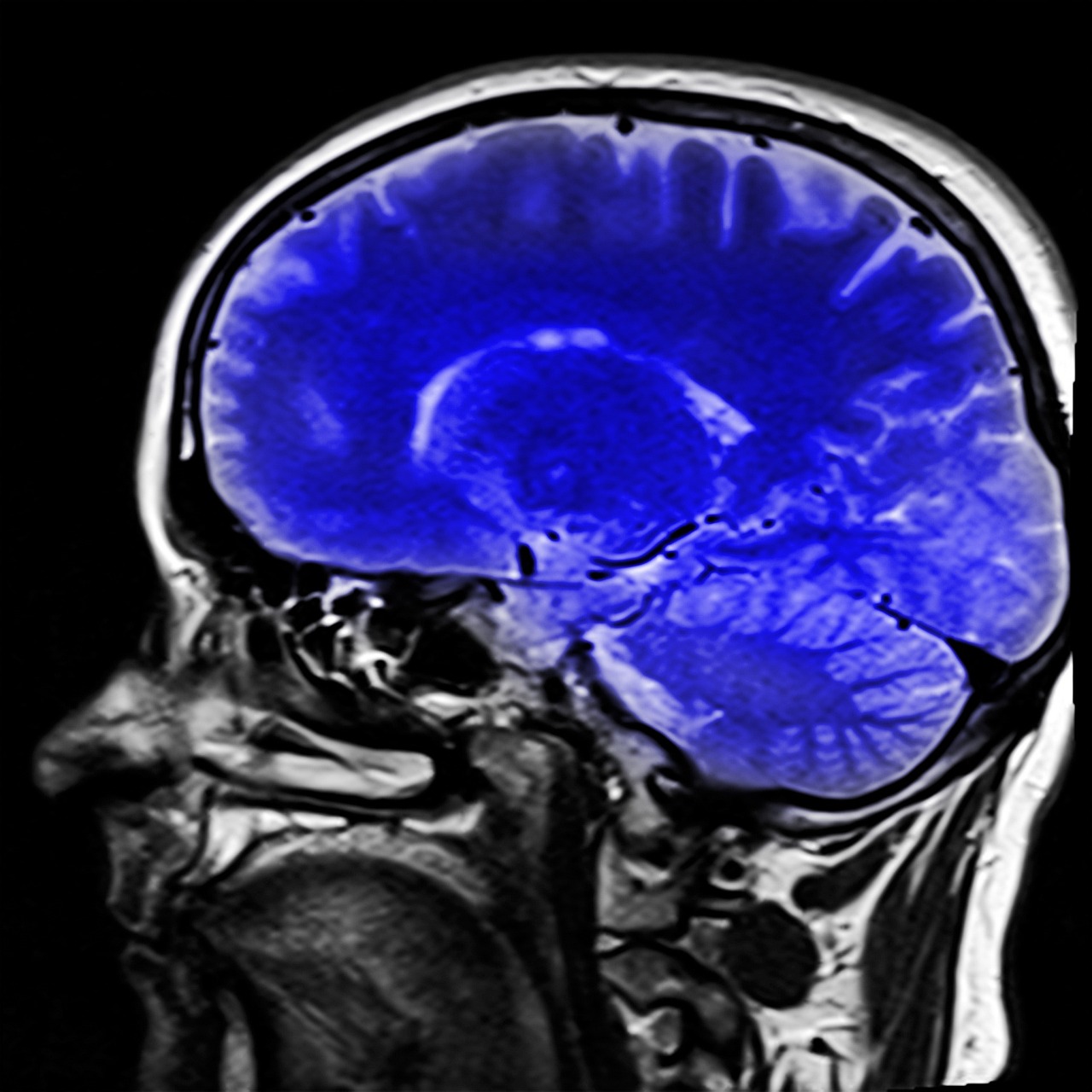 How is Consciousness Affected By Age?